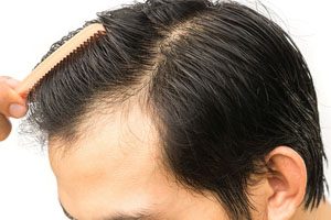 About | Hair Transplant | Premier Dermatology and Cosmetic Surgery